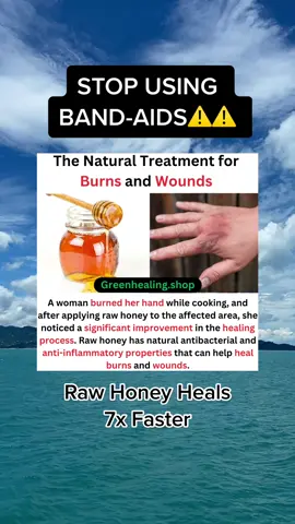 Raw honey is better than band-aids #bandaids #rawhoney #healing #heals #health #bodycuts 