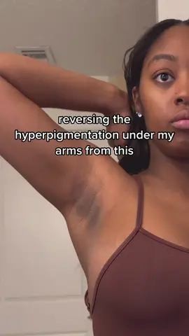 We got recipe for brightening your underarms. This with the brightening stick is unmatched! #fyp #skincaretips #skinbrightning #hyperpigmentation #darkunderarms #kojicacidsoap #brighteningdeodorant 