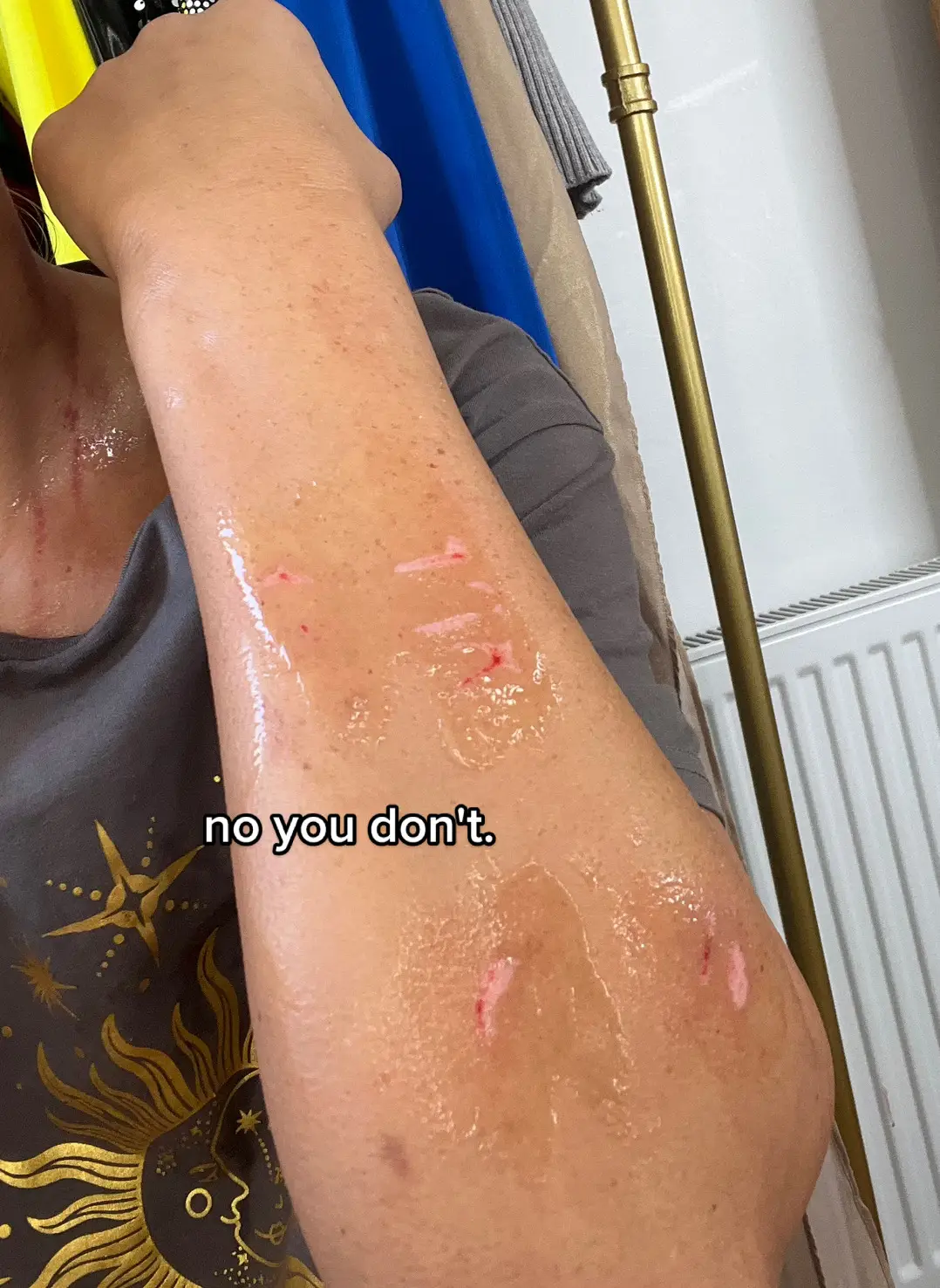 what a perfect photo to jump on this trend with, love being scratched and attacked and then being told i'm loved after, anyway... would say you want see her but me personally i could never do that to someone i loved/cared about thats why she ain't got one mark on her. #toxic #lesbiandrama #fyp #bye 