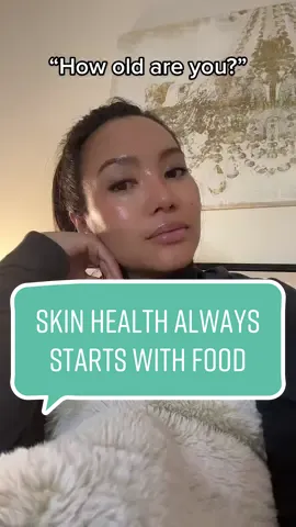 Skincare is more about what you consume internally and your diet plays a crucial role in the health of your skin! When you consume foods rich in vitamin C, A, zinc etc., they can protect your skin from free radicals, inflammation & improve elasticity. & consuming highly processed foods & unhealthy fats can have a negative impact on skin that can lead to acne, dullness or premature aging. I also turn 37 in less than a month & have never done botox or any other type of injection #healthyskintips #glowingskin #skinhealthtips #healthyskinhacks #antiaging #supplmentsforskin 