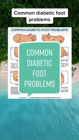 Common diabetic foot problems. See my bio today ⏰ #diabetic #diabetes #type2 #diabetichealth #diabetesawareness 