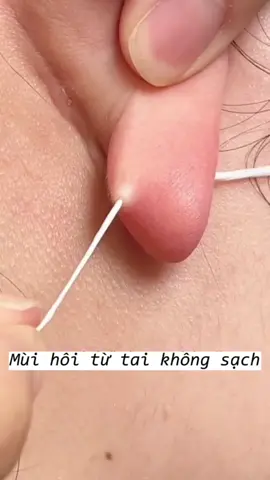 Vệ sinh lỗ đeo khuyên 