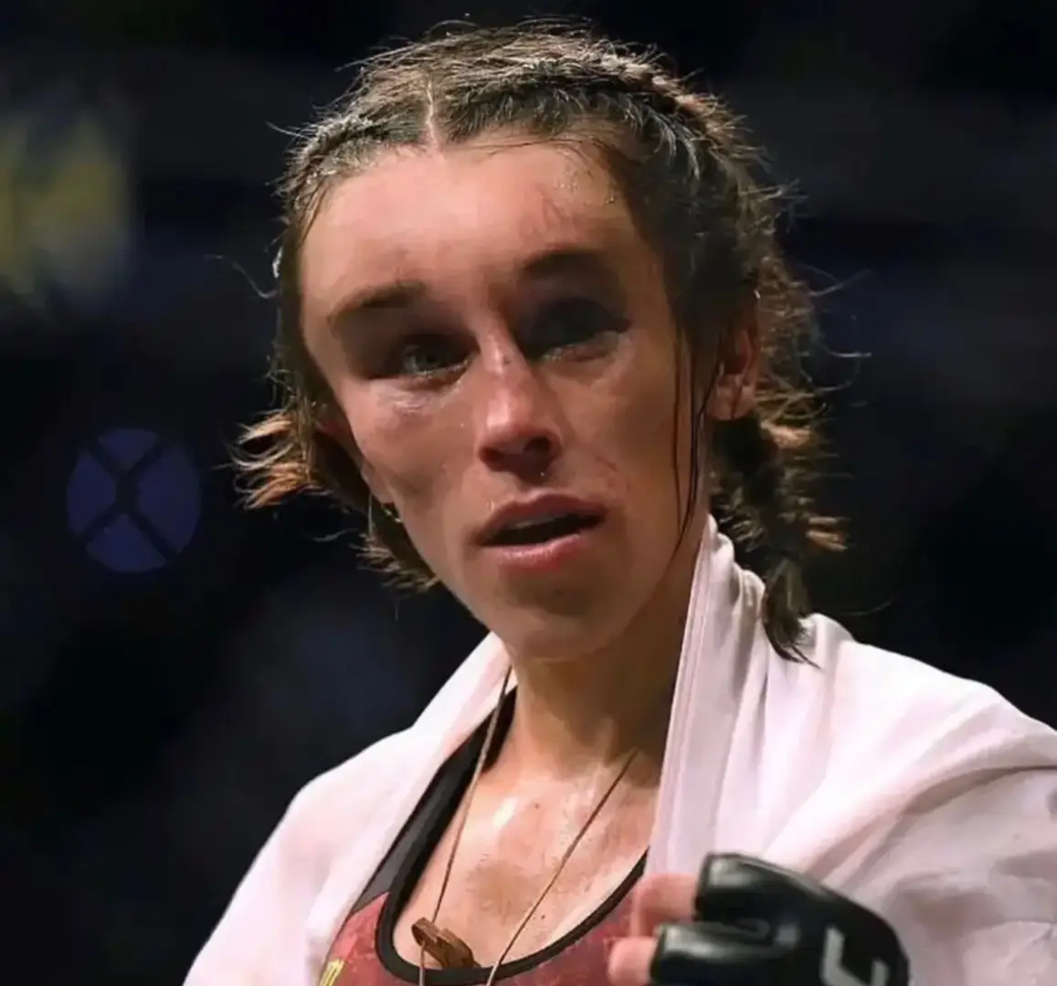 Joanna Jedrzejczyk's face left unrecognizable after a UFC fight with Zhang Weil, last slide shows her face before the fight. #fyp 