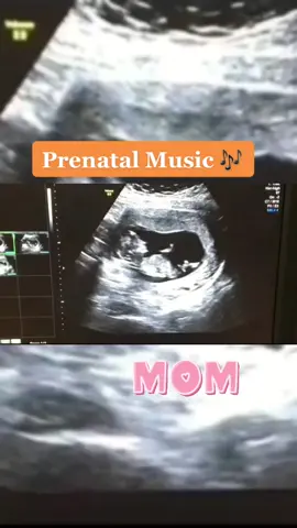 How many months are you pregnant?#babymusic #pregnant #babyshark #babylove #babymama 