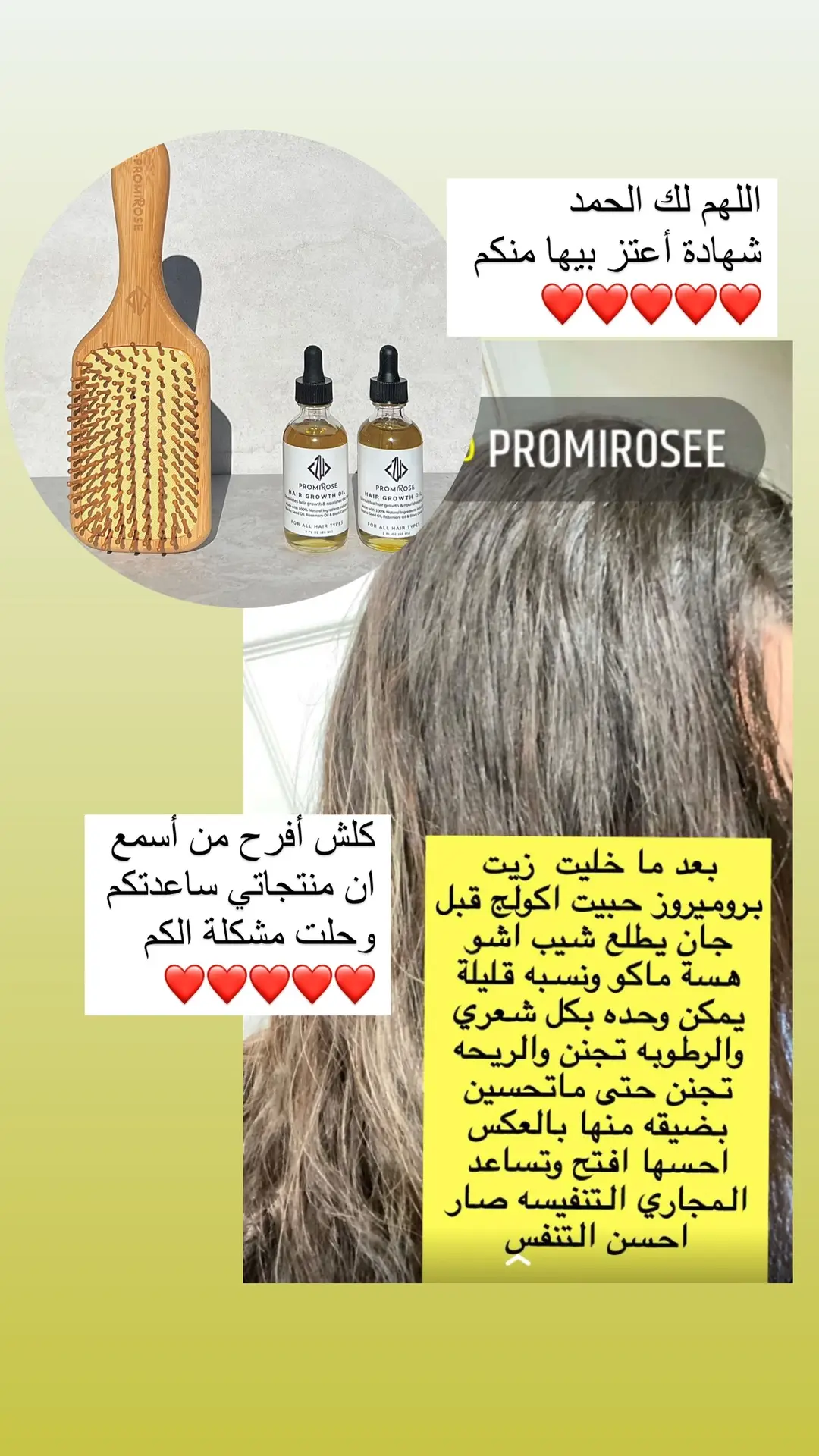 الزابط في البايو للطلب promirose.com #promirose #يروميروز#hairloss #hairgrowth 