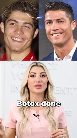What cosmetic procedures has Cristiano Ronaldo had done?💉 #cristianoronaldo #cr7 #worldcup #ronaldo #celebrity #filler #plasticsurgery #transformation #botox #fy #fyp #viral 