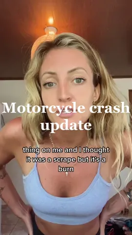 DO NOT DRINK AND DRIVE #motorcycle #motorcyclecrash #storytime #drinking 