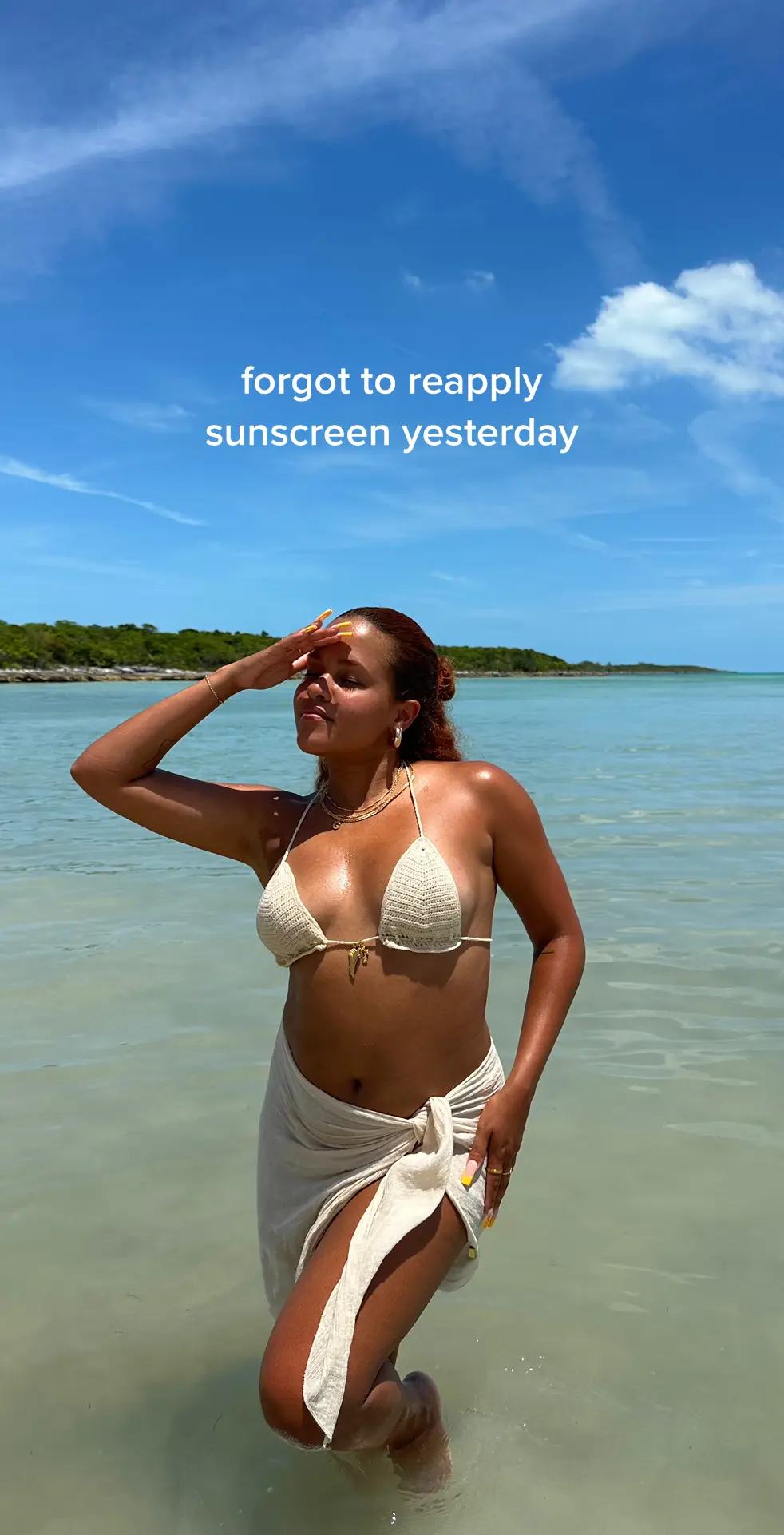 Dont be like me & think you wont get sunburn just cause your tan😅