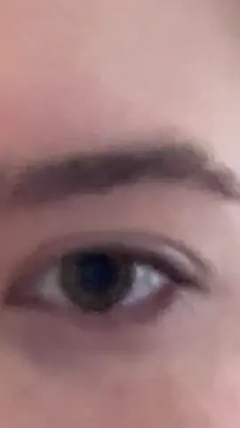 What colour is my eye?🤔