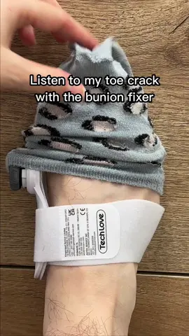 #crack #toes #bunion #fixer 