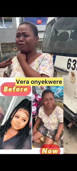 Watch: If you know how we can locate her parents pls send a dm Love Oluebube needs help, she is not her self, she doesn’t remember anything but she’s not mád I kept her in a hotel so tomorrow I proceed with how we can help her regain her sanity, she is not depressed but she couldn’t lay hands on how this even started, she found herself not dressing well again. Just watch the video #viralvideo #fyp #explorepage #therapy #viral #humanity  