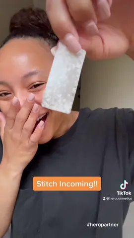 @ anyone struggling with large breakouts!! This is for you!!​ #heropartner @Mariah Clayton  #heroemployee #herocosmetics #mightypatch #mightypatchsurface
