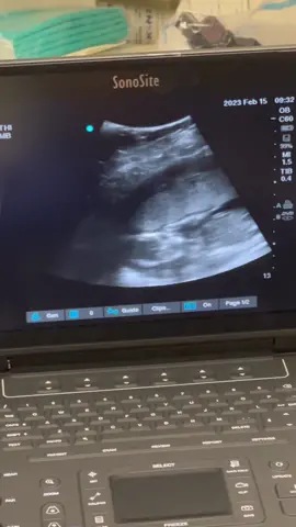 Im super happy for my little prince 👑 #babyboy #boymom #genderreveal #2023baby #rainbowbaby 