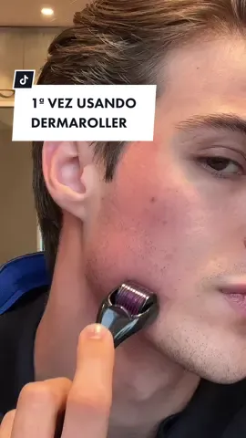PRIMERA VEZ USANDO DERMAROLLER / COMO USAR DERMAROLLER 🥵🥹 #dermaroller #menskincare #skincareroutine #habitosaludables #cuidadopersonal #colageno 