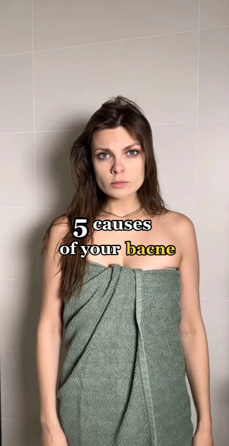 Wanna know how to get rid of bacne? Then you may also want to know what can cause it, to prevent it’s appearance.  #bacneproblem #bacnecauses #bacnenomore