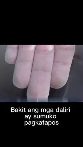 Bakit kulubot ang mga daliri pagkatapos ibabad sa tubig?#daliri #katawan #Kaalaman #tubig