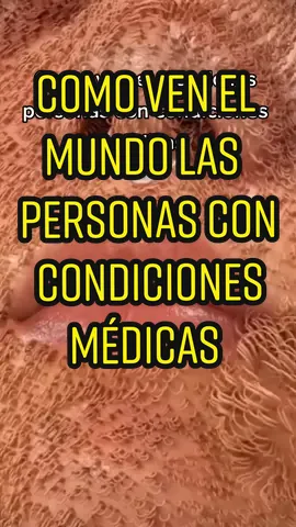 Así ven el mundo las.personas con ansiedad. Su corazón se acelera, dejan de enfocar correctamente y en casos extremos todo se vuelve oscuro y confuso #curiosidad #ansiedad #anxiety #curiosity #enfermedad #parati #fyp 