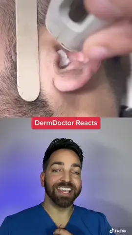 Laser hair removal #dermdoctor @Ada_Beauty_ 