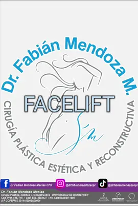 #drfabianmendozacpr  #Guadalajara #drfabianmendoza #bellezanatural #facelifted #facelifte #guadalajara #rinofamm #facelift #Antesydespués 
