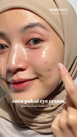 Ternyata pake eye cream takarannya kebanyakan justru bisa bikin milia?! 🫠🥹  Siapa disini yang masih salah pake eye cream? Yuk kita belajar bareng dari kesalahan sebelumnya biar area under eye gak cepet kena kerutan. Disini aku pake eye cream dari The Originote yaa! Harganya murah banget, cocok buat pemula, tapi dari segi kandungan juga oke! 😉 #widymeisya #rekomenwidsky #racunwidmey #skincarewidy #markhas #theoriginotewidy #eyecream #belajarskincare #milia 