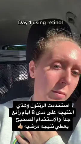 #ratinol  #ريتنول #larocheposay #لاروش_بوزيه #اكسبلور #عنايه #متجر #بوتيك 