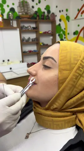 Dudak  Piercing işlemi 😇 videolarımızı profildeki linki tıklayarak YouTube kanalımızdan izleyebilirsiniz.  İsland  Tattoo  piercing  stüdyosunda  İbrahim uzunoğlu tarafından yapılmıştır. #tattoo #tattoos #piercing #gebze #piercings #lip #lippiercing #dudak #dudakpiercing 