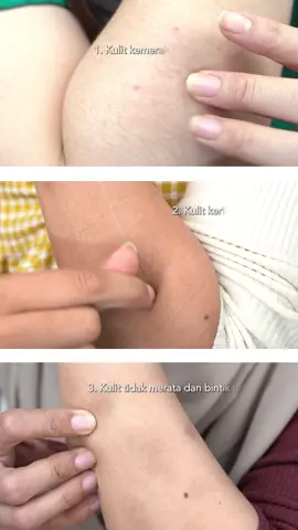 kulit kamu kering? bisa! kulit kamu berjerawat? bisa juga! kulit kamu mau lebih cerah? bisa juga! serius! pilih aja YOU Bodefine sesuai dengan permasalahan kulit kamu! masih bingung? cek di Live yuk yaaaa #bodycare #bodyserum 