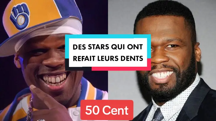 Les stars n’hésitent pas à parfaire leur visage avec de nombreux rendez-vous chez le dentiste. Découvre des célebrités qui ont refait leurs dents. #dents #dentsblanches #dentsdestars #celebrites #carousel