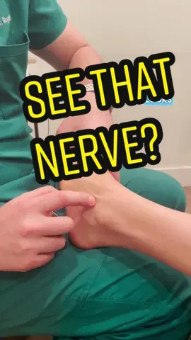 See that nerve in the #foot? Thats the superficial peroneal nerve. Many docs and therapists say you cant feel nerves in the body. We respectfully disagree. This is the #superficialperonealnerve. If you have a #tinglyfoot this could be why. 