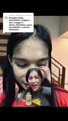 Replying to @Julia Belo Aytt Ano yan?😱😱😱 MINOXIFIED💛#fyp #fypシ #fypage #foryoupage #fypシ゚viral #entransition #entransitionbeauty #gandangentransition #healthyskinforall #minoxified #minoxidilresult #minoxifiedresult 