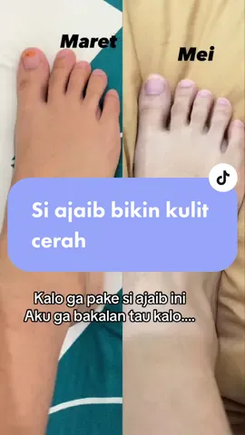 Ga kaleng kaleng emang hasilnya💫🫶 #sabunpyary #sabunpyarynalpamara #sabunturmeric #sabunpyaryturmeric #pyary #pyarysoap #pyarysoapwhitening #sabunviral #nalpamarasoap #turmericsoap #pyaryturmericsoap #pyarynalpamara #sabunmandi #sabunmuka 