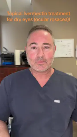 Topical ivermectin can be an effective adjunct treatment to treating dry eyes secondary ocular rosacea-commercial medications include Soolantra 1% or it can be compounded into a cream along with metronidazole and azelaic acid #ocularrosacea #dryeye #demodex #dryeyetreatment 