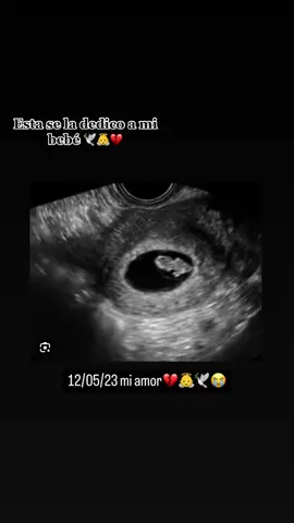 #🎧tanito_jc🎧 #enestanosepudocorazon🥺no #no #🎶🎶 #aunqueisimosloposible🥺😭😭 #nologramoslamision #bebeenelcielo👣👼 #😟😟😟 #viral 