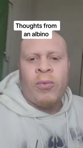 just some thoughts from a dude with albinism.🙂