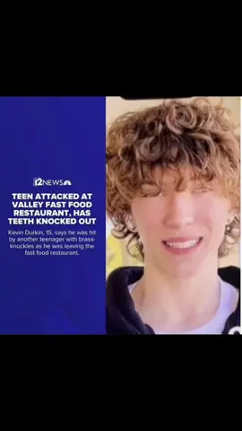 Please help donate to fix my nephews smile after some idiot punched him with brass knuckles 😭🥺 https://gofund.me/2dd0a5db #viral #viralvideo #gofundme #help #teeth #smile #crime #justice #justiceforkevin #nephewlove #nephew #fyp #fypシ #foryoupage #foryou #fypage #fypシ゚viral 