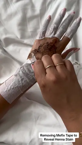 Removing Mefix Tape 😍 #mehndi #stain #freshstain #henna #mefixremoval #mefixtape #wedding #bride #reception #indian 