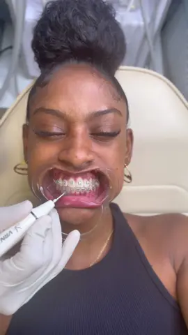 @dental_impact 🫶🏽
