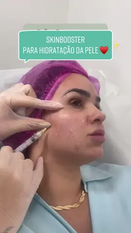 Deixe seu rosto brilhar com o poder do Skinbooster! 💫✨ Hidrate sua pele de dentro para fora e desfile uma aparência impecável! #hidrataçãointensa #pelebrilhante #skinbooster #pelehidratada 