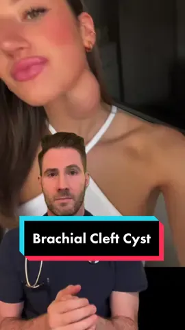 Brachial cleft cyst @Hols #brachialcleftcyst #neckmass #congenitalanomaly #doctor 