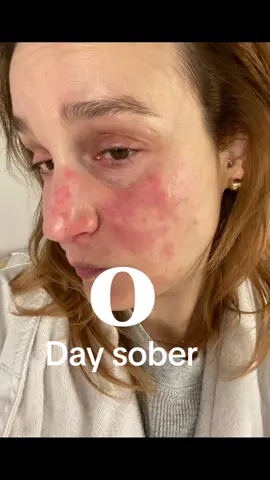 #foryou #sober #soberreels #sobertrend #0day #transformation 