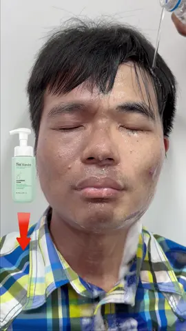Saya sangat senang produk ini membuat wajah saya sangat bersih dan halus!✨ #sheeureka  #cleanser  #cleanserfoam  #facialwash  #facewash  #skincare #beauty