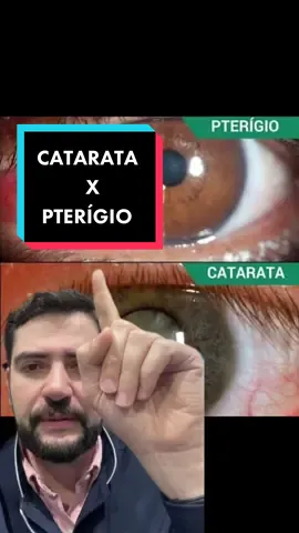 VOCE DABE A DIFERENÇA?🤔 #wilsondimartini #dimartini #catarata #pterigio #oftalmologia #maringa #olhos #visao #maringapr 
