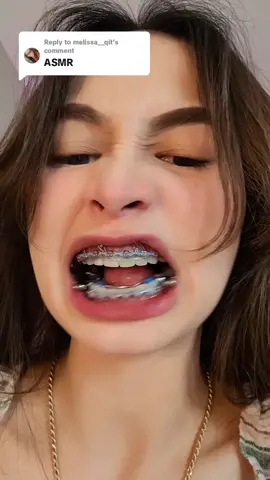 Replying to @melissa__qit The sounds  like Im eating Metal 🥹😅 #herbst #herbstappliance #trending #fypシ #foryou #foryoupage #tiktok #tiktokphillipines #california #usa #xyzbcafypシ #ortho #orthodontics #trending 