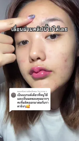 ตอบกลับ @วิภาวรรณ ฯ.   ไม่อยากหายแนะนำให้เลื่อนผ่านไป!! #รีวิวบิวตี้ #เรื่องผิว #ชับบี้ #เจลแต้มสิวชับบี้ 