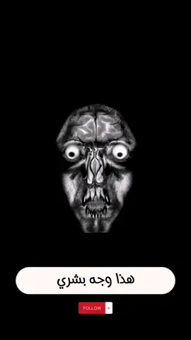 الصور المرعبة من جهاز التصوير MRI ☢️ وليش بننصح بتصوير ال Ultrasound #fypシ゚viral #foryoupage #shorts 