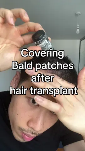Trying the Toppik Hair building fibers & setting spray 🤔  #MenHairLoss #hairtransplant #asianhairloss #hairtransformation #ukhairloss #malepatternbalding