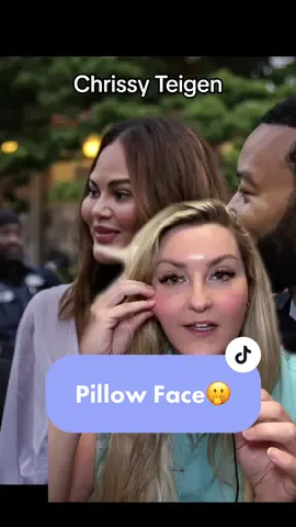 We can help you avoid “pillow face” from too many fillers! #pillowface #overfilledlips #fillerdonts #kyliejenner #chrissyteigen #thecosmeticqueens #greenscreen 