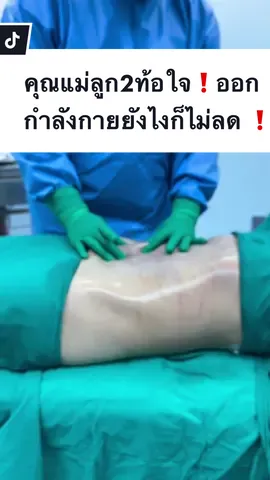 คุณแม่ลูก2ออกกำลังกายยังไงก็ไม่ลด ตัดสินใจมาดูดไขมันบวกกับทำJ-Plasma กับคุณหมอคิด #ดิอาทคลินิก #theartclinic #ดูดไขมัน #reviewดูดไขมัน #รีวิว #sixpack 