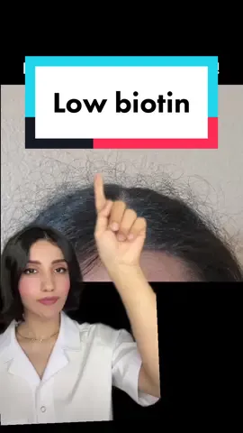 Low biotin levels can cause: brittle nails, dry scaly skin, crack corner of mouth, Hair breakage, hairloss, dry eyes, fatigue and red eyes.  Some of the best sources of biotin include legumes, egg yolks, organ meats, nuts, seeds, mushrooms, avocados, sweet potatoes, and yeast. #biotin #biotindeficiency #vitamindeficiency 