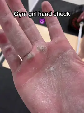 Ouch edition #gym #palestra #fyp #fypシ #callus #calluses #calli #hand #check #gymgirl #callusesremover #callusesremoval #mani 